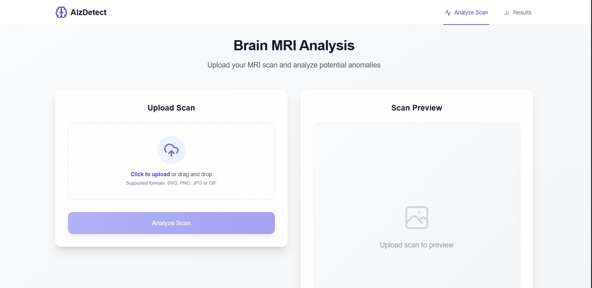 AlzDetect – AI-Powered Alzheimer's Detection System
